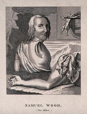 view Samuel Wood, a man whose shoulder and arm were torn off in an accident at a mill. Engraving by Cook.