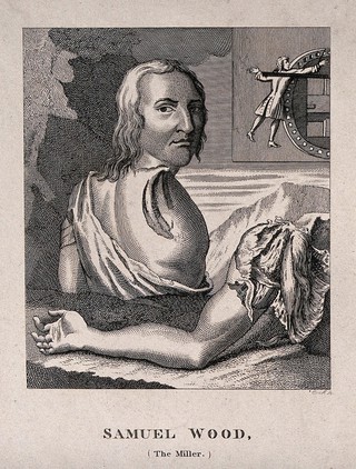 Samuel Wood, a man whose shoulder and arm were torn off in an accident at a mill. Engraving by Cook.