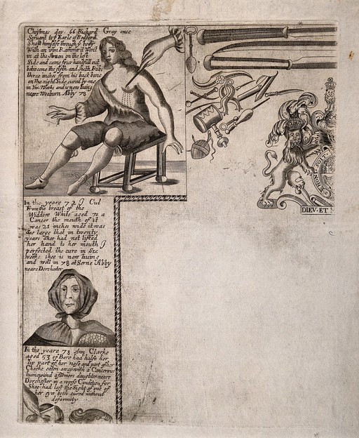 Two vignettes illustrating surgical feats and instruments.