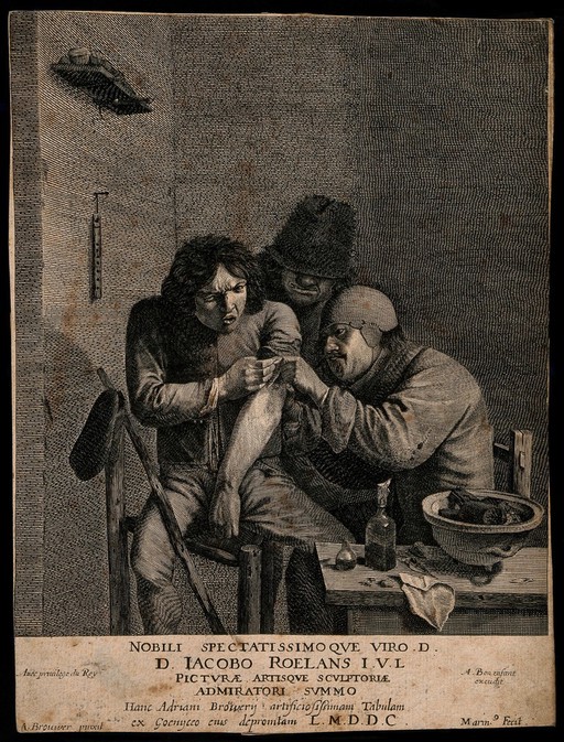 A surgeon dressing the wound of a grimacing patient. Line engraving by L. Marin (?) after A. Brouwer.