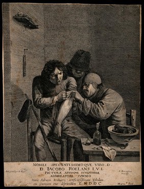 A surgeon dressing the wound of a grimacing patient. Line engraving by Marinus van der Goes after A. Brouwer.