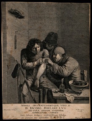 view A surgeon dressing the wound of a grimacing patient. Line engraving by Marinus van der Goes after A. Brouwer.