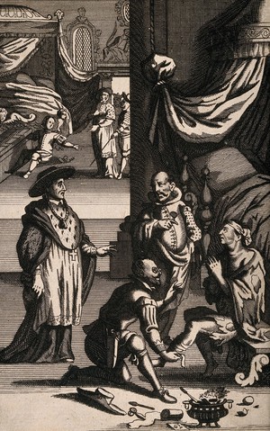 view A surgeon bandaging a patient's knee after applying a cautery, a clergy man and a wealthy patron (?) are observing the situation. Engraving.