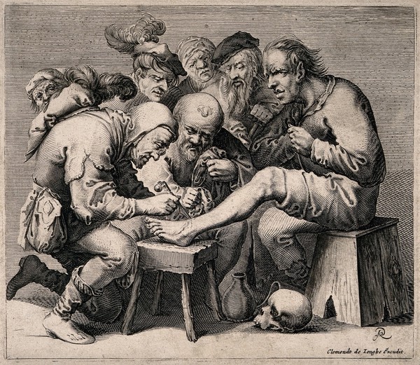 An operator treating a patient's foot; a crowd of people is gathered around watching the work. Line engraving by P. Quast.