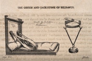 view Two pieces of apparatus that are used to manipulate dislocated shoulders and jaws back into the correct position, apparently conceived by W. Fabricius Hildanus. Etching by J. Bell.