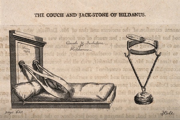 Two pieces of apparatus that are used to manipulate dislocated shoulders and jaws back into the correct position, apparently conceived by W. Fabricius Hildanus. Etching by J. Bell.