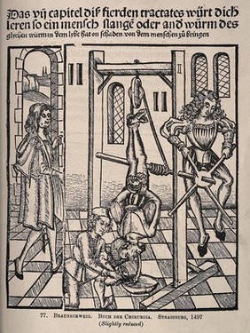 A male patient is hanging by his feet from an apparatus, a large worm (?) is passing from his mouth into a bowl, assisted by a surgeon and two assistants. Process print after a woodcut, 1497.