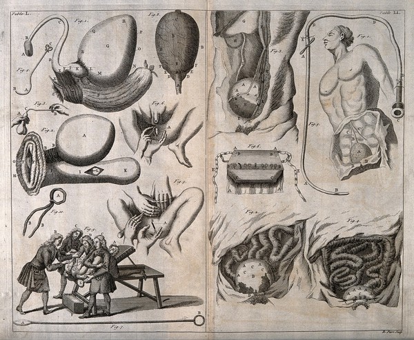 A surgeon performing a lithotomy on a patient who is being restrained by three assistants, with ten other anatomical illustrations. Engraving by R. Parr.