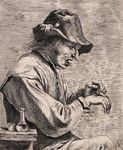 A man removing a plaster from his hand. Etching attributed to D. Teniers, the younger.