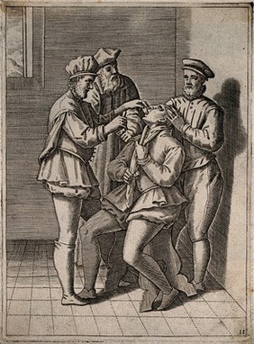 A surgeon about to bleed a man's tongue, he is aided by two assistants. Engraving, 1586.