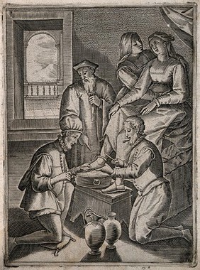 A surgeon about to bleed a woman's foot, he is observed by an older surgeon and aided by an assistant, another woman comforts the patient. Engraving, 1586.