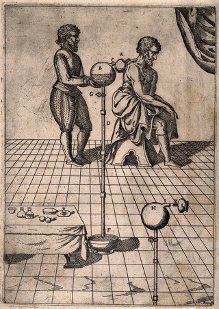 A surgeon applying the method of cupping to a patient. Etching by A. Brambilla.