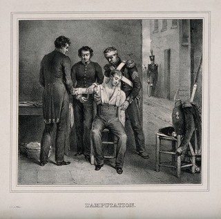 A military surgeon amputating the arm of soldier in the open air. Lithograph by F. le Villain.