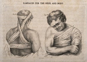 view The upper body and head and ways of bandaging them. Stipple engraving by J. Bell.