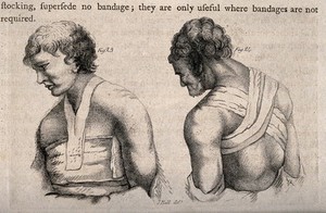 view The upper body and head and ways of bandaging them. Stipple engraving by J. Bell.