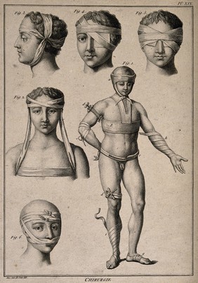 Six diagrams illustrating different methods of bandaging the body and use of tourniquets. Line engraving by J.E. de Sève.