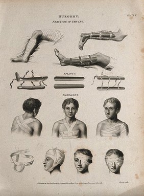 Diagrams illustrating: bandaged legs in splints, bandaged upper bodies and bandaged heads and eyes. Engraving by W. Lowry, 1811, after J. Farey, the younger (?).