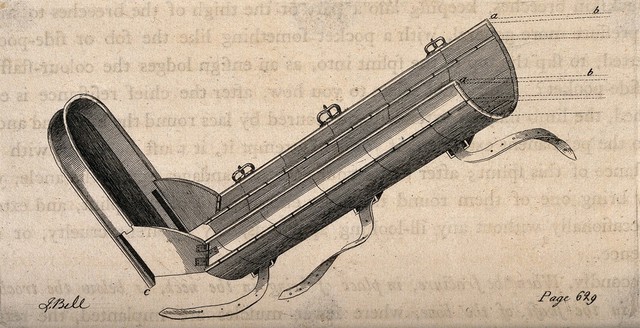 A splint for a broken limb. Etching by J. Bell.