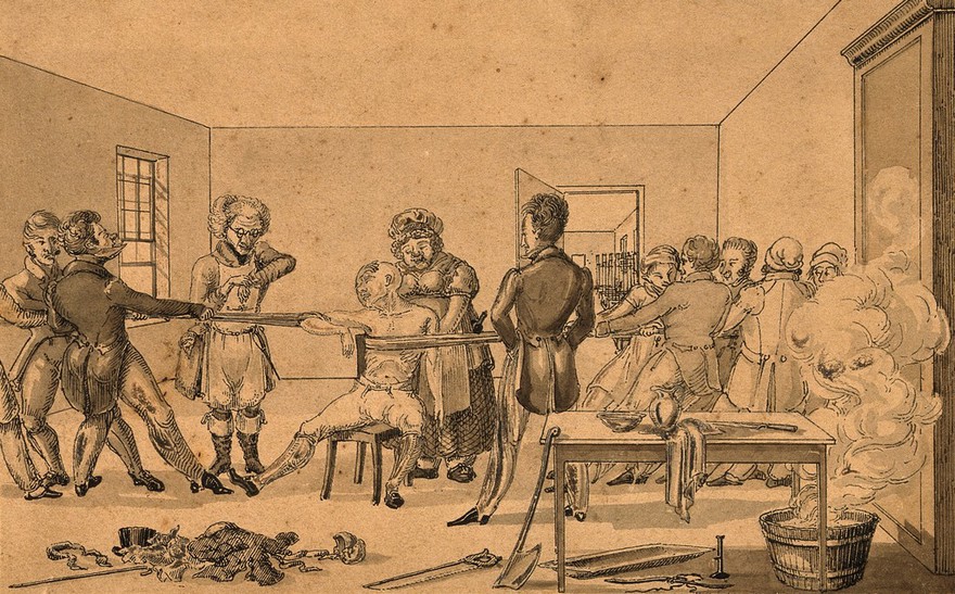 A surgeon supervising two groups of people pulling in opposite directions in order to cure a man with a shoulder dislocation. Pen drawing.