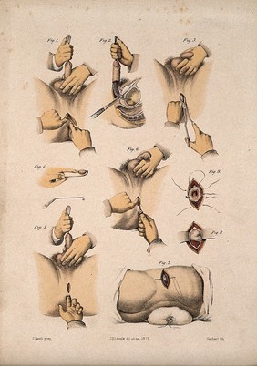 Nine cross-sections through the male reproductive organs, urinary system and anus. Coloured lithograph by M. Hanhart after C. Heath after J.B. Léveillé.