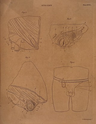 Four diagrams illustrating cross-sections of the male reproductive organs. Etching by E. Mitchell.