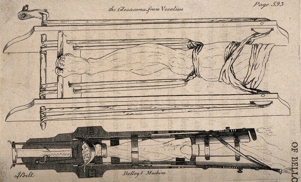 Two diagrams comparing two sets of apparatus for the leg designed by Vesalius and Belloq. Etching by J. Bell.