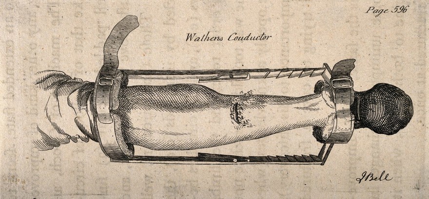 A piece of apparatus designed by J. Wathen to bind together a broken leg. Etching by J. Bell.