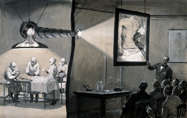 A periscope being used above an operation which is projected onto a lantern screen for a lecture in the adjoining room. Gouache painting by W.R. Seton.