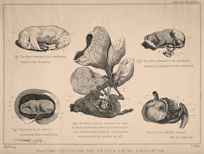 Horse foetuses: five figures showing the foetus of a horse during the gestation period, with dissections of its abdomen and stomach demonstrating the foetal circulation system. Engraving by T. Cowan after B. Herring, ca. 1860.