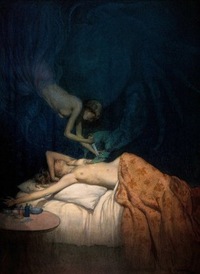 A giant claw pierces the breast of a sleeping naked woman, another naked woman swoops down and stabs the claw with a knife; representing the surgical treatment of breast cancer. Watercolour by R. Cooper.