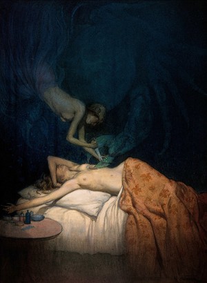 view A giant claw pierces the breast of a sleeping naked woman, another naked woman swoops down and stabs the claw with a knife; representing the surgical treatment of breast cancer. Watercolour by R. Cooper.