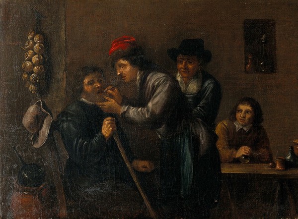 A surgeon extracting a tooth. Oil painting.