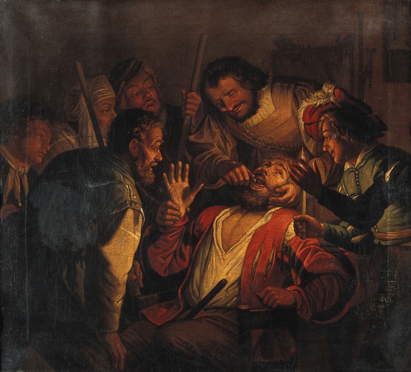 A surgeon extracting a tooth. Oil painting after Gerrit Honthorst., by Gerard van Honthorst