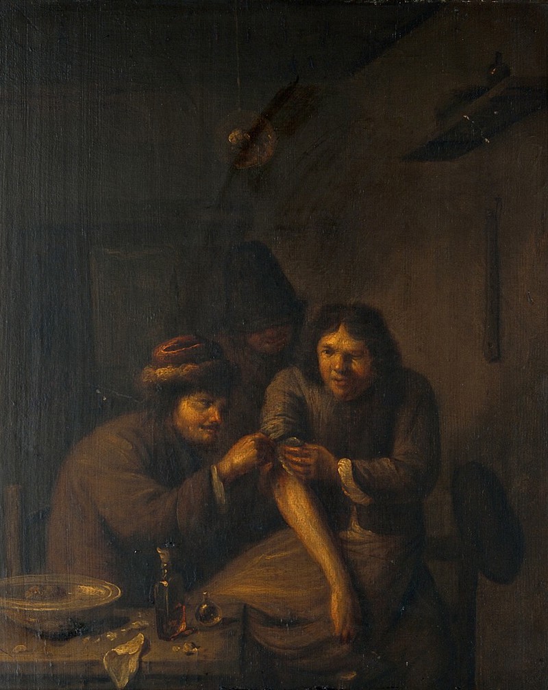 A surgeon attending to a man's arm. Oil painting after Adriaen Brouwer., by Adriaen Brouwer
