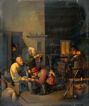 view A surgeon operating on a man's foot. Oil painting after A. Brouwer.