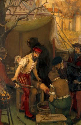 Ambroise Paré using the ligature when amputating at the siege of Damvillers, 1552. Oil painting by Ernest Board.