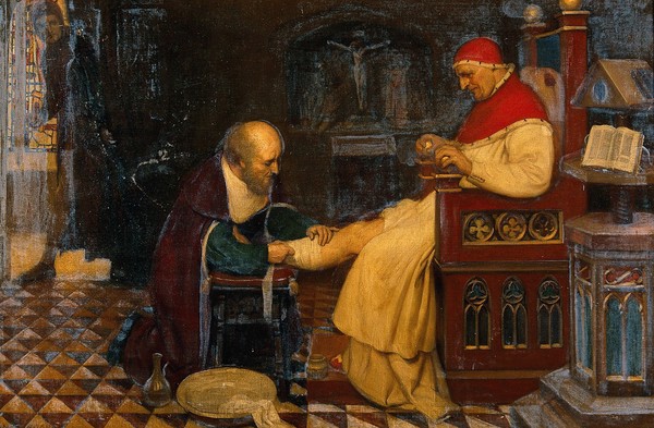 Guy de Chauliac bandaging the leg of Pope Clement VI at Avignon, while Petrarch, his enemy, jealous of his influence, watches him, ca. 1348. Oil painting by Ernest Board.