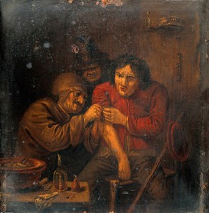 view A surgeon attending to a man's arm. Oil painting after Adriaen Brouwer.