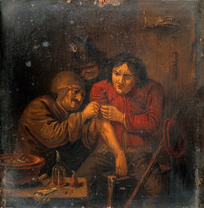 A surgeon attending to a man's arm. Oil painting after Adriaen Brouwer.