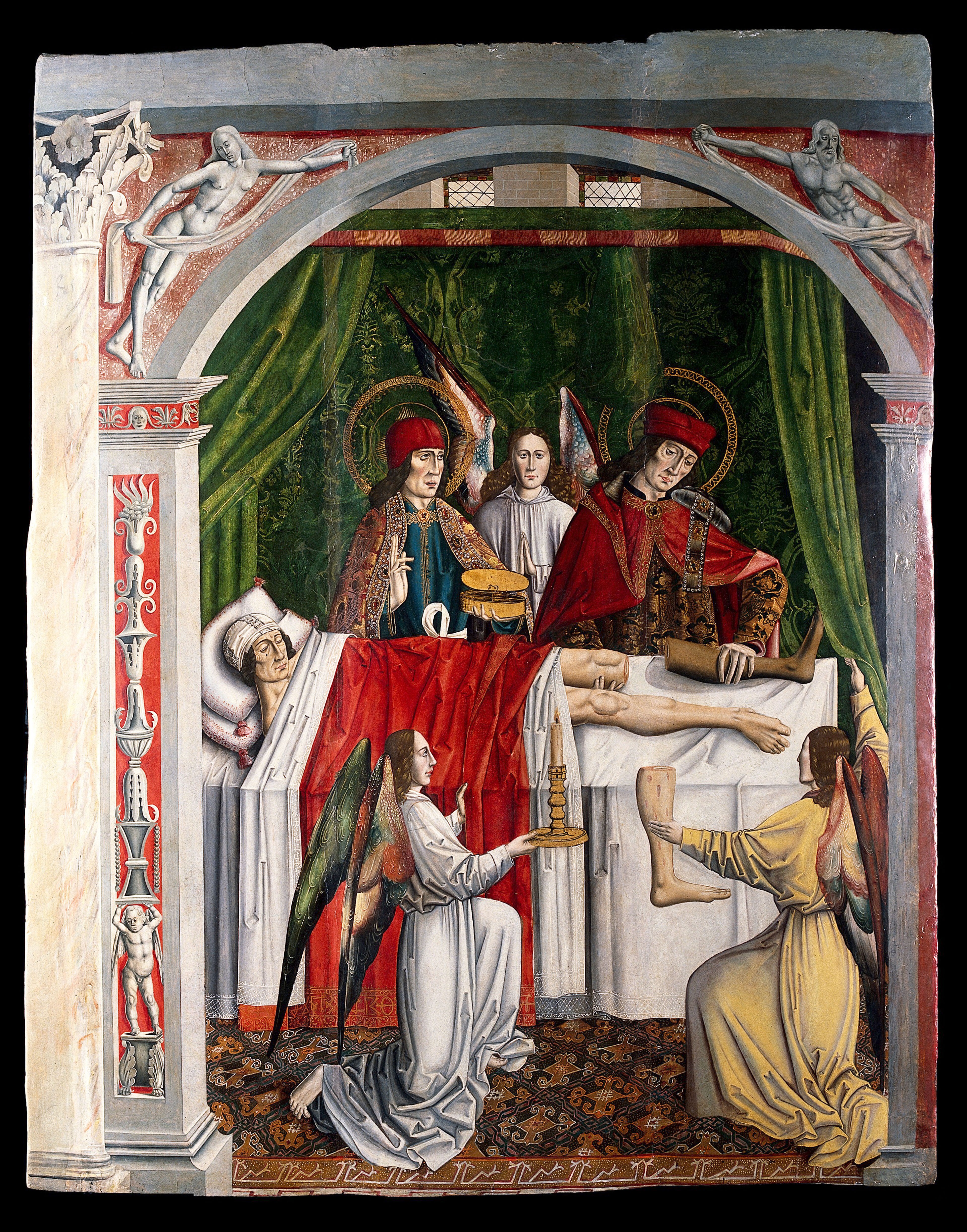 A verger's dream: Saints Cosmas and Damian performing a miraculous cure by transplantation of a leg. Oil painting attributed to the Master of Los Balbases, ca. 1495.