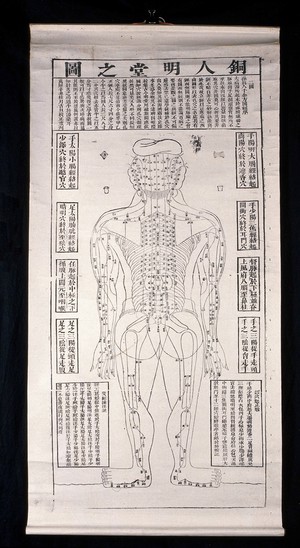 view Acupuncture/pressure points on the back of the body (spinal pressure points). Woodcut by a Chinese artist.