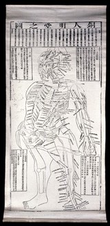 Acupuncture points. Woodcut by a Japanese (?) artist.