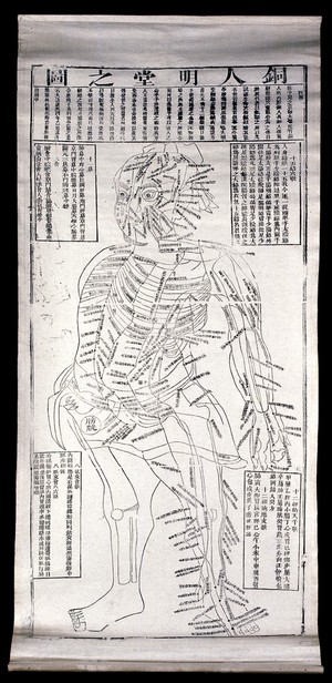 view Acupuncture points. Woodcut by a Japanese (?) artist.