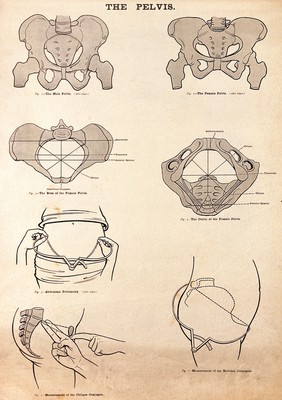 The pelvis in pregnancy. Lithograph after W. F. Victor Bonney.