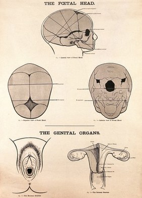 The foetal head and female genital organs. Lithograph after W. F. Victor Bonney.