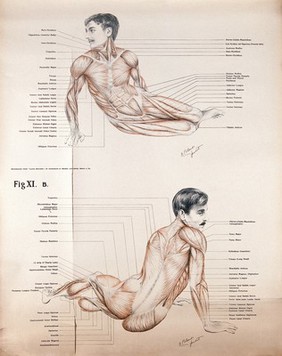 Artistic poses, plates XIA and B: two figures of men écorchés. Lithograph by Robert J. Colenso.