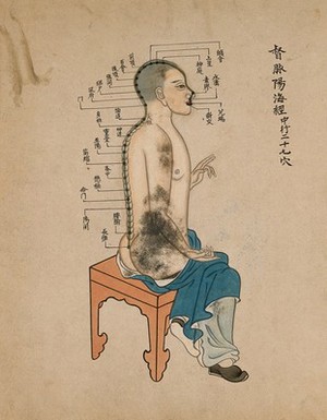 view Acupuncture chart with a series of points indicated on the figure of a seated Chinese man. Watercolour, China, 17--.