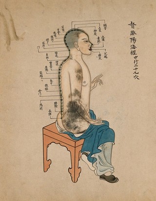 Acupuncture chart with a series of points indicated on the figure of a seated Chinese man. Watercolour, China, 17--.