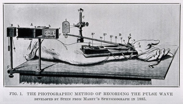 S.T. Stein's adaptation of E.J. Marey's sphygmograph. Process print after a wood engraving.