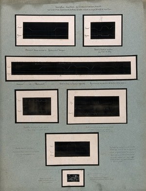 view Variations of the pressure of feet on the ground and movements of the head, whilst running (?). Chart by Etienne-Jules Marey.